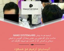 ترمیم موی سر به روش HRS و Nano syatem