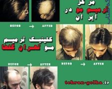 کلینیک تخصصی ترمیم مو گلهای تهران