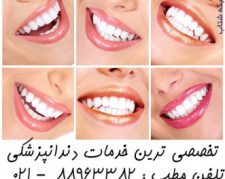 بهترین دندانپزشک تهران معروف ترین دندانپزشک تهران متخصص لمینیت