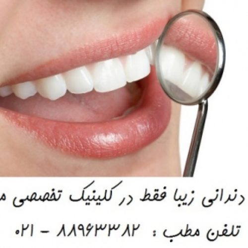 قیمت روکش دندان بهترین متخصص دندانپزشکی زیبایی