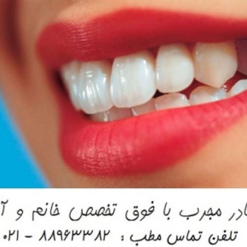 خدمات دندانپزشکی زیبایی سفید کردن دندان طراحی لبخند هالیوودی