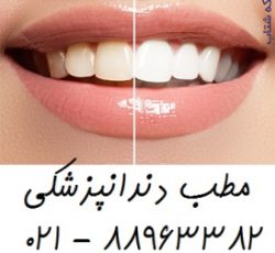 بهترین دندانپزشکی مرکز تهران عصب کشی دندان