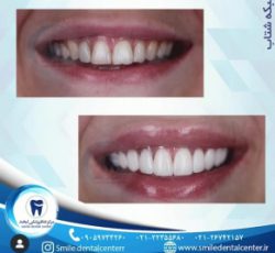 کلینیک دندانپزشکی لبخند،جراحی ایمپلنت پیشرفته،درمان ریشه،ترمیم دندان و …