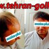 اولین موسسه ترمیم مو نانوارگانیک ایران