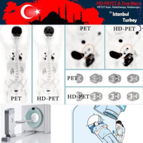 PET-CT و PET Scan (رادیوتراپی – پرتودرمانی) در ترکیه