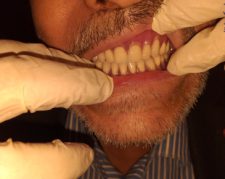 لابراتوار دندانسازی ساخت و تعمیر و ترمیم دندان مصنوعی