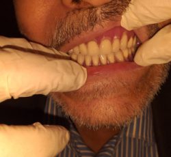 لابراتوار دندانسازی ساخت و تعمیر و ترمیم دندان مصنوعی