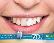 انجام تخصصی بریج دندان و ترمیم دندان با تخفیف 70 درصدی