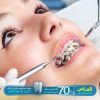 انواع خدمات و درمان های دندانپزشکی با تخفیف 70 درصدی