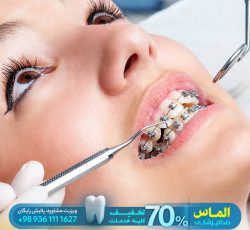 انواع خدمات و درمان های دندانپزشکی با تخفیف 70 درصدی
