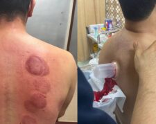 کلینیک طب سنتی (عنبیه شناسی، مزاج شناسی، حجامت، فصد، بادکش، زالو درمانی و…)