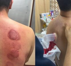 کلینیک طب سنتی (عنبیه شناسی، مزاج شناسی، حجامت، فصد، بادکش، زالو درمانی و…)