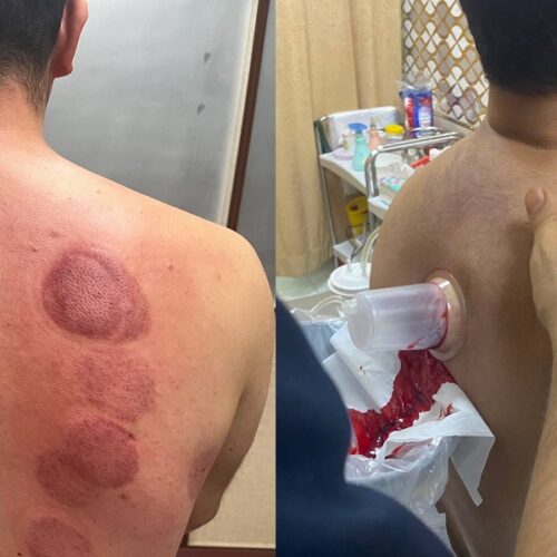 کلینیک طب سنتی (عنبیه شناسی، مزاج شناسی، حجامت، فصد، بادکش، زالو درمانی و…)